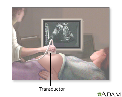 El ultrasonido en el embarazo