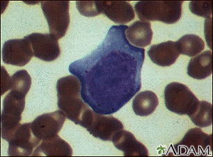 Mononucleosis - microfotografía de células