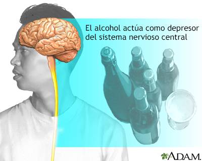 Transtorno por consumo de alcohol