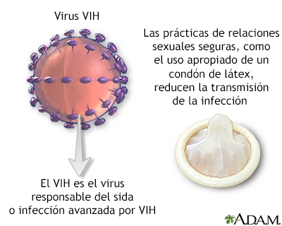 VIH