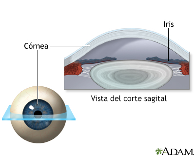Cirugía ocular con Lasik - serie - Anatomía normal