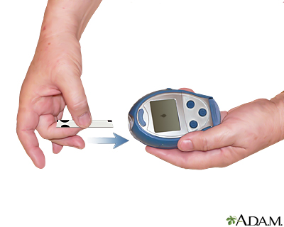 Medición del nivel de glucosa en la sangre - Inserte una tira reactiva