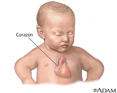 Defecto congénito del corazón - serie - Anatoma del corazn del beb