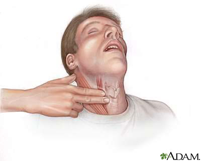 Pulso del cuello