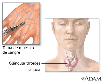 Examen de función tiroidea