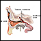 Inserción de un tubo en el oído - serie - Anatomía normal