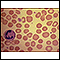 Red blood cells - spherocytosis