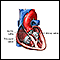 Cirugía de las válvulas cardíacas - Serie