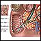 Reparación quirúrgica de la obstrucción biliar - serie - Anatomía normal