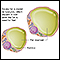 Lipocytes (fat cells)