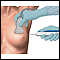 Biopsia por aguja de núcleo de la mama