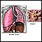 Pulmones y alveolos normales