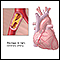 Obstrucción de las arterias coronarias