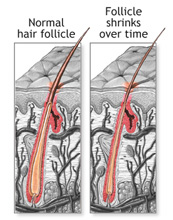 follicle