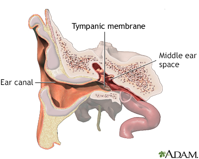 Normal anatomy