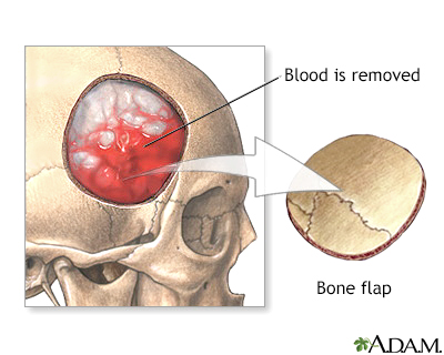 Procedure