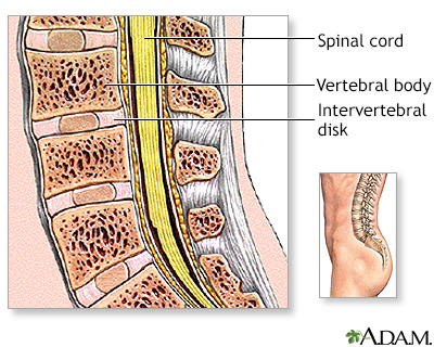 Lumbar spinal surgery - Series
