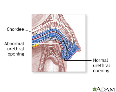 Procedure