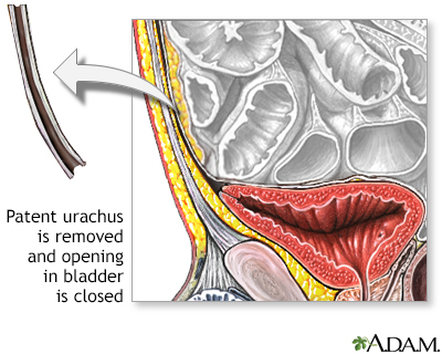 Procedure