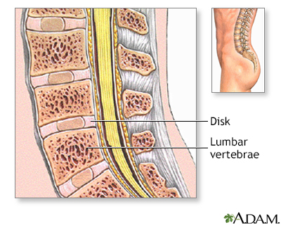 Normal anatomy