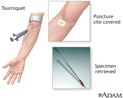 Procedure, part 1