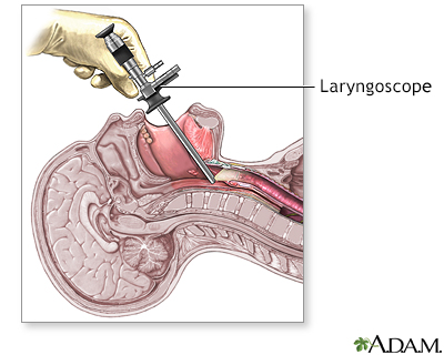 Procedure, part 1