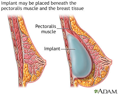 Procedure, part 2