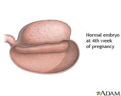 4 Week Old Fetus