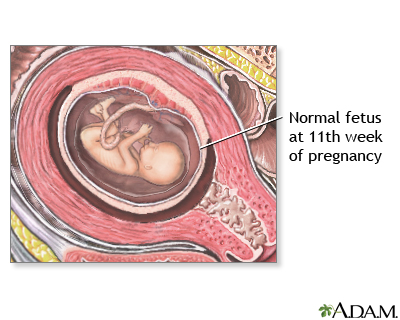 11 Week Old Fetus