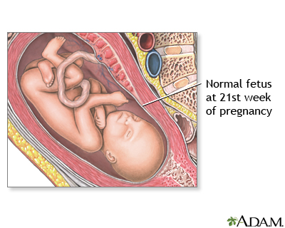 21 Week Old Fetus