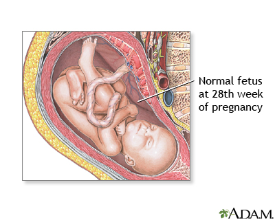 28 Week Old Fetus