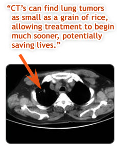 FS CT scans tumor