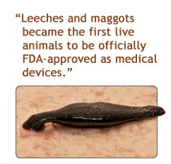 How Leeches Can Save Lives And Limbs for Some Patients