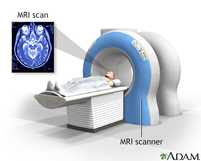 Head MRI