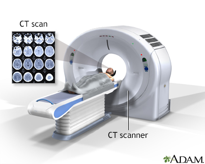 Head CT