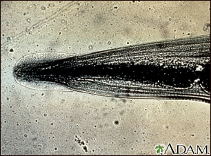 Pinworm - close-up of the head