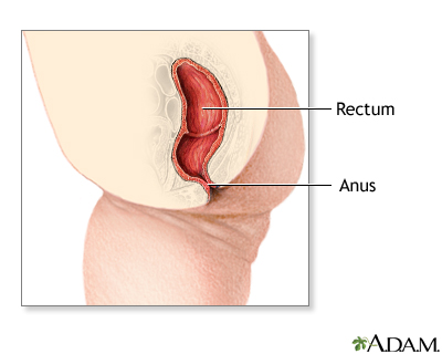 Imperforate anus repair - series