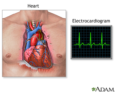 Electrocardiogram (ECG)