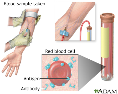 Antibody titer