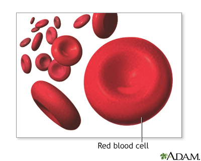 Hypochromia