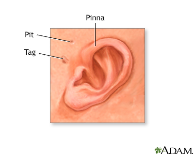 Newborn ear anatomy