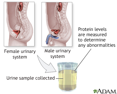 Protein urine test