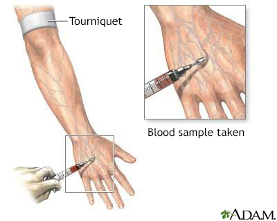 Blood test