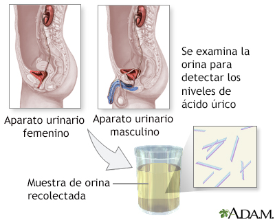 Prueba de ácido úrico