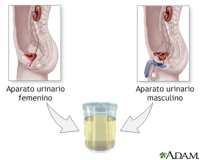 Muestra de orina