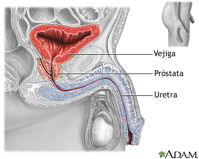 Prostatectomía - serie - Anatomía normal