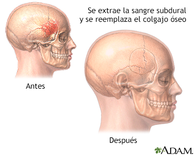 Cuidados postoperatorios