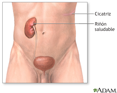 Cuidados postoperatorios