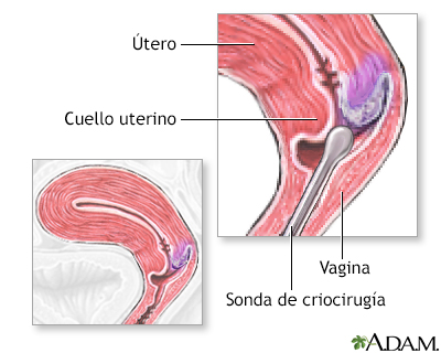 Procedimiento (primera parte)