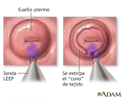 Procedimiento (segunda parte)